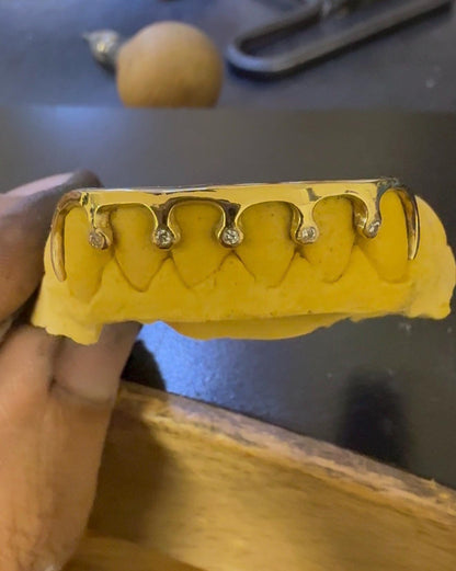 Luxury custom drip style grillz with Lab VVS diamonds photographed on black background