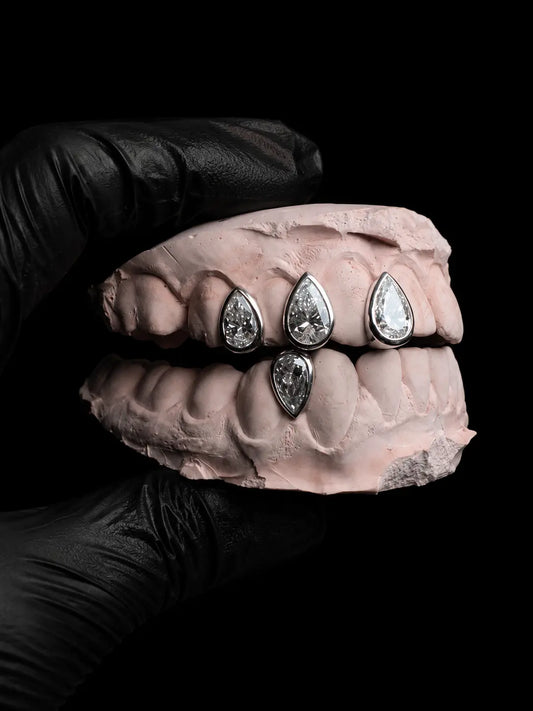 Close-up of luxury pear-cut diamond grillz handcrafted in solid gold with VVS stones