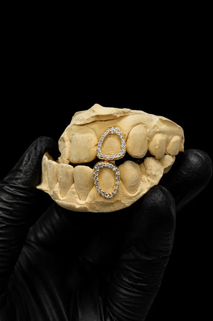 Luxury custom iced out grillz worn with diamond moissanite shine