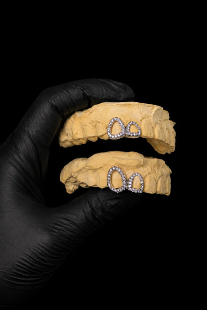 Custom silver and gold open window grillz displayed on dental mold