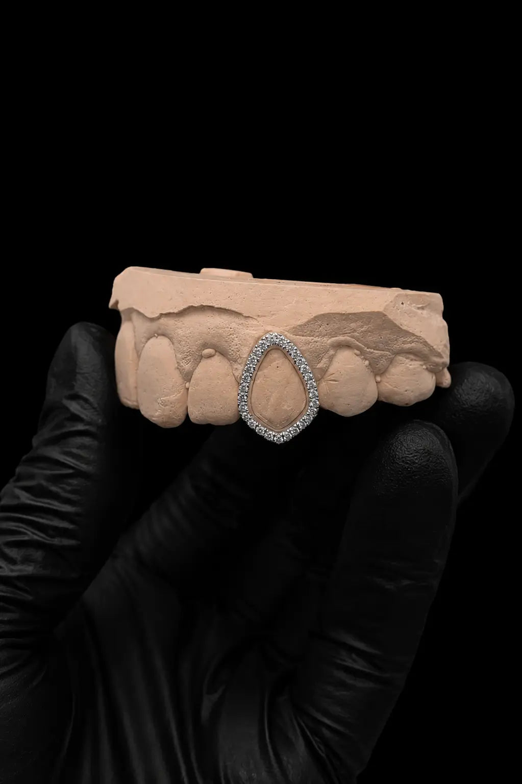 Luxury custom lab grown diamond grillz worn with premium shine