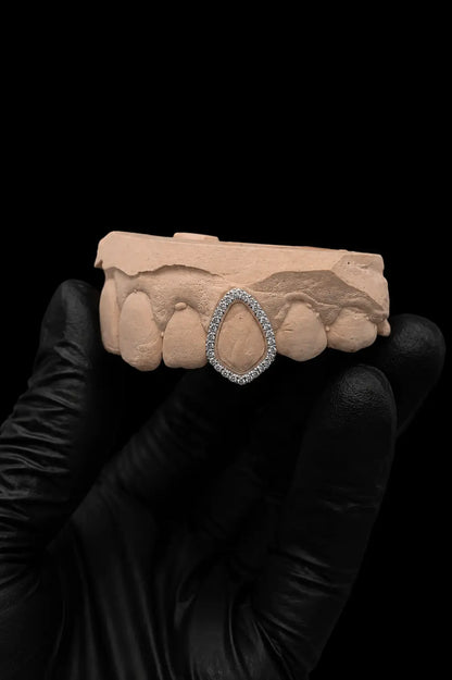 Luxury custom lab grown diamond grillz worn with premium shine