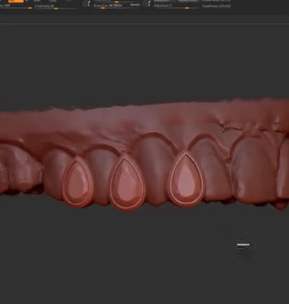 CAD software render of custom pear-cut diamond grillz design with precision stone placement