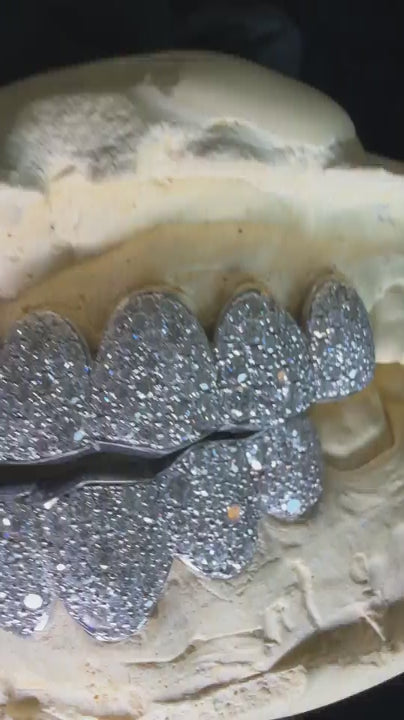 Try-on video of fully iced-out Bustdown Snowset diamond grillz