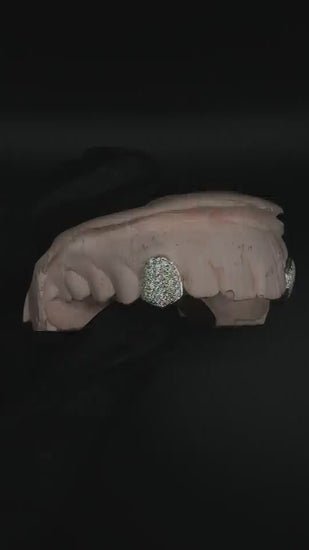 Single moissanite grillz displayed in hand with sparkling stones