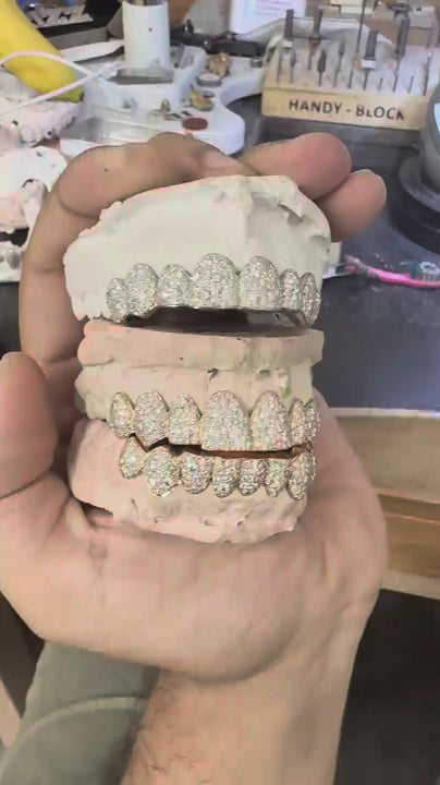 Close-up video showcasing custom moissanite mosaic snowset grillz with brilliant iced out shine in sterling silver and gold