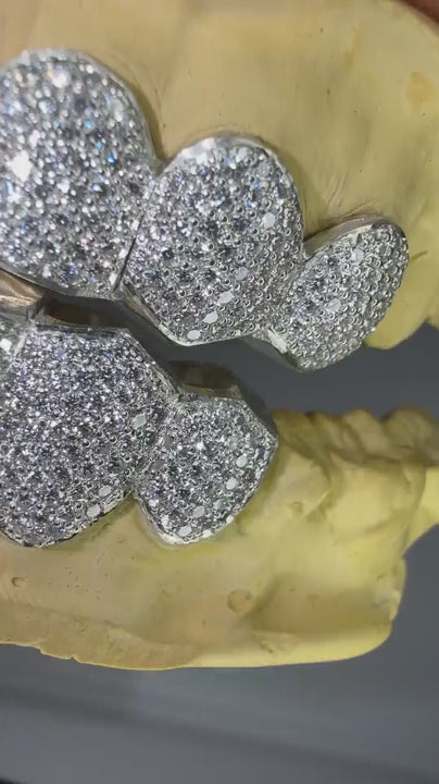 Close-up video of custom VVS moissanite grillz sparkling under studio lighting
