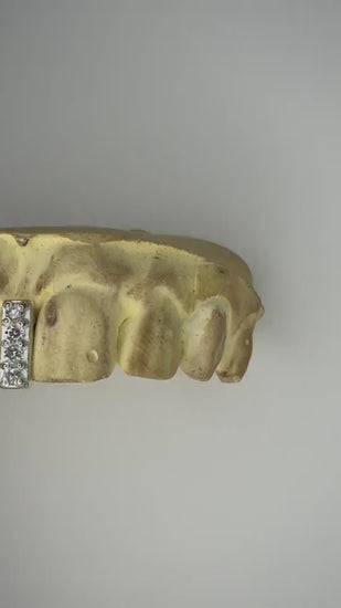 White diamond custom gap grillz displayed on a dental mold with luxury black background and black gloves showcasing handcrafted iced out tooth caps