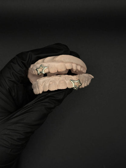 Close up of custom star shape grillz with polished silver and gold detailing