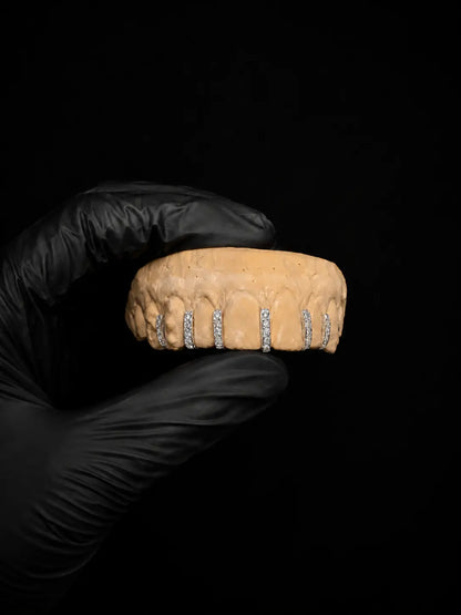 Black-gloved hand holding a dental model with diamond-studded braces against a black background